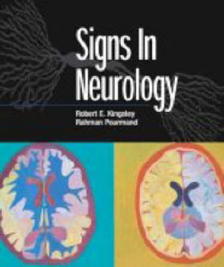 Signs in Neurology