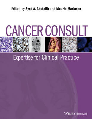 Cancer Consult &ndash; Expertise for Clinical Practice - Syed A. Abutalib