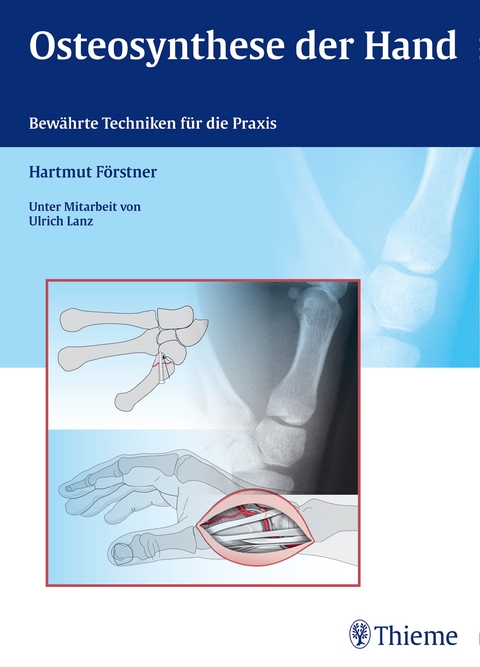 Osteosynthese der Hand - Hartmut F&ouml;rstner