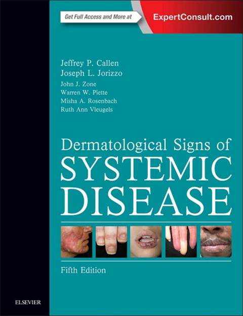 Dermatological Signs of Systemic Disease E-Book -  Jeffrey P. Callen,  Joseph L. Jorizzo,  Warren Piette,  Misha Rosenbach,  Ruth Ann Vleugels,  John J. Zone
