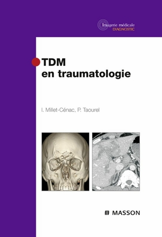 TDM en traumatologie