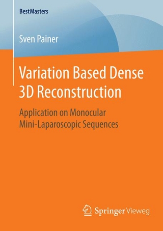 Variation Based Dense 3D Reconstruction