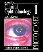 Clinical Ophthalmology