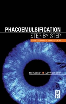 Phacoemulsification