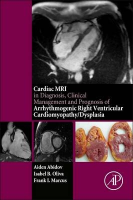 Cardiac MRI in Diagnosis, Clinical Management, and Prognosis of Arrhythmogenic Right Ventricular Cardiomyopathy/Dysplasia