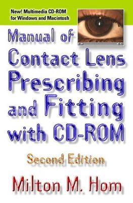 Manual of Contact Lens Prescribing and Fitting - Milton M. Hom
