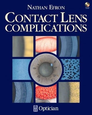 Contact Lens Complications - Nathan Efron