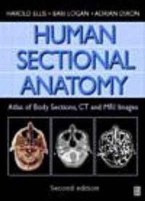 Human Sectional Anatomy, 2Ed - Adrian Dixon, Harold Ellis, Bari Logan
