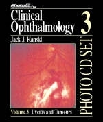 Clinical Ophthalmology