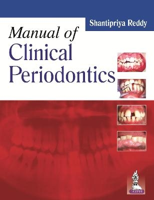 Manual of Clinical Periodontics