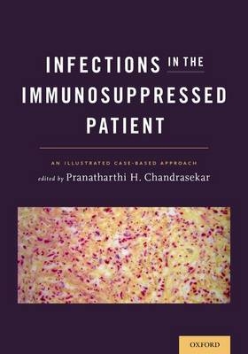 Infections in the Immunosuppressed Patient - 