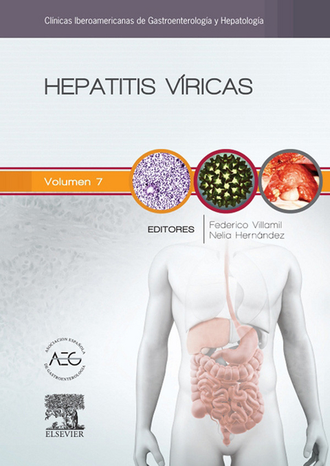 Hepatitis v&iacute;ricas - 