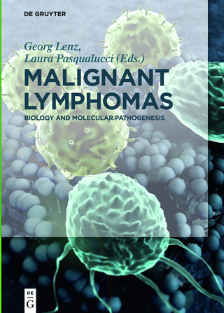 Malignant Lymphomas