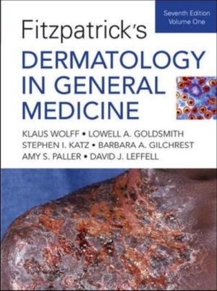Fitzpatrick's Dermatology In General Medicine, Seventh Edition: Two Volumes