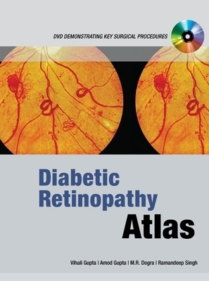 Diabetic Retinopathy Atlas - Vishali Gupta, Amod Gupta, M.R. Dogra, Ramandeep Singh