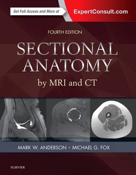 Sectional Anatomy by MRI and CT E-Book -  Mark W. Anderson,  Michael G. Fox