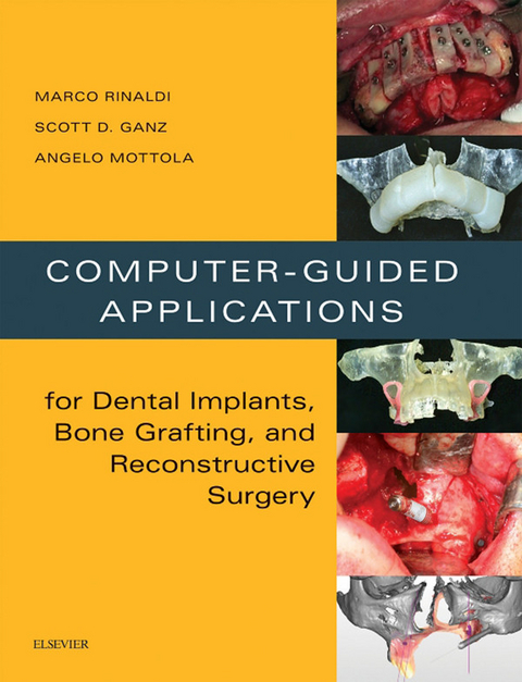 Computer-Guided Dental Implants and Reconstructive Surgery -  Scott D Ganz,  Angelo Mottola,  Marco Rinaldi