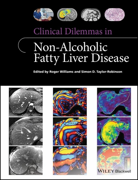 Clinical Dilemmas in Non-Alcoholic Fatty Liver Disease - Roger Williams, Simon D. Taylor-Robinson