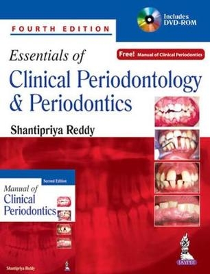 Essentials of Clinical Periodontology and Periodontics