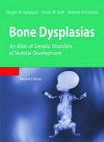 Bone Dysplasias