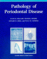 Pathology of Periodontal Disease