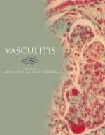 Vasculitis - 