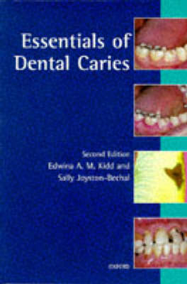 Essentials of Dental Caries - Edwina A. M. Kidd