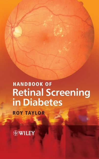 Handbook of Retinal Screening in Diabetes - Roy Taylor