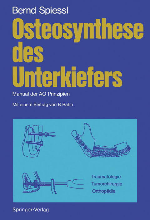 Osteosynthese des Unterkiefers - Bernd Spiessl