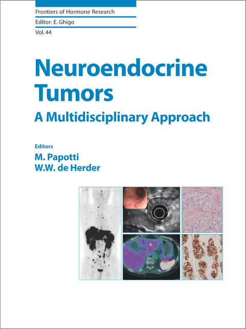 Neuroendocrine Tumors: A Multidisciplinary Approach - 