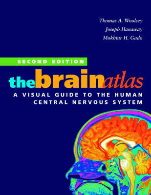 The Brain Atlas