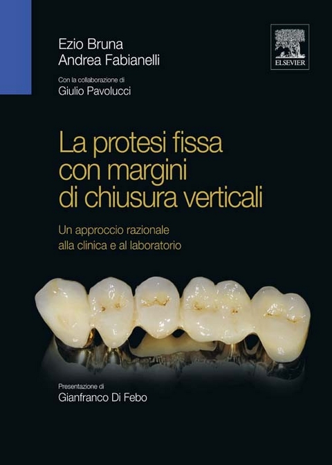 La protesi fissa con margini di chiusura verticali -  E. Bruna,  A. Fabianelli