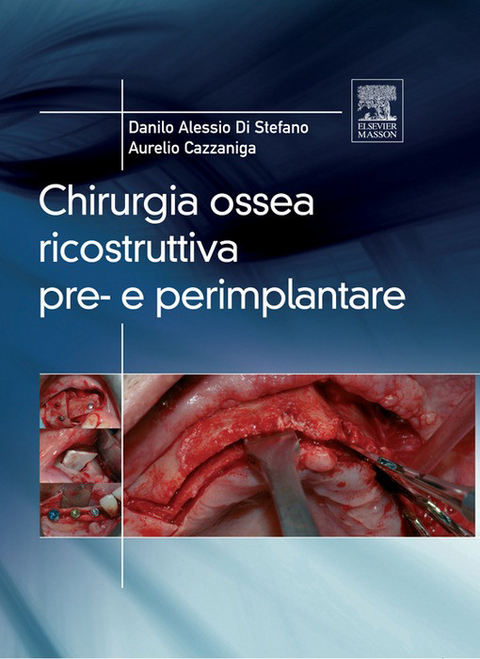 Chirurgia ossea ricostruttiva pre-e perimplantare -  Danilo Alessio Di Stefano,  Aurelio Cazzaniga