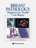 Breast Pathology - Paul Peter Rosen