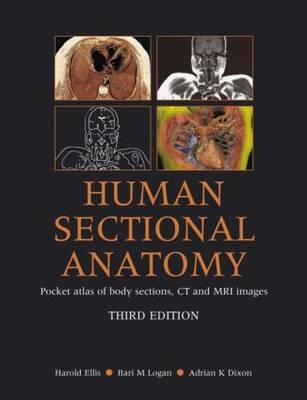 Human Sectional Anatomy - Harold Ellis, Bari M Logan, Adrian K. Dixon