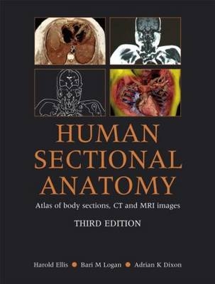 Human Sectional Anatomy - Harold Ellis, Bari M Logan, Adrian K. Dixon