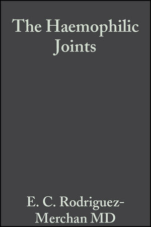 The Haemophilic Joints - 