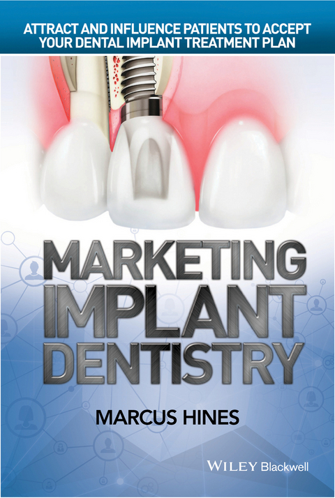 Marketing Implant Dentistry -  Marcus Hines