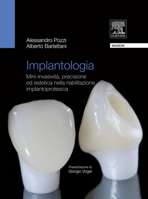 Implantologia -  Alessandro Pozzi,  Alberto Barlattani