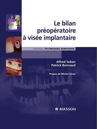 Le bilan preoperatoire a visee implantaire