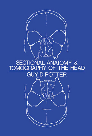 Sectional Anatomy and Tomography of the Head