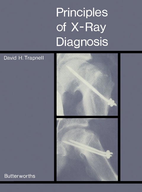 Principles of X-Ray Diagnosis -  David H. Trapnell