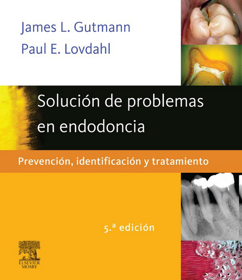 Soluci&oacute;n de problemas en endodoncia -  James L. Gutmann,  Paul E. Lovdahl