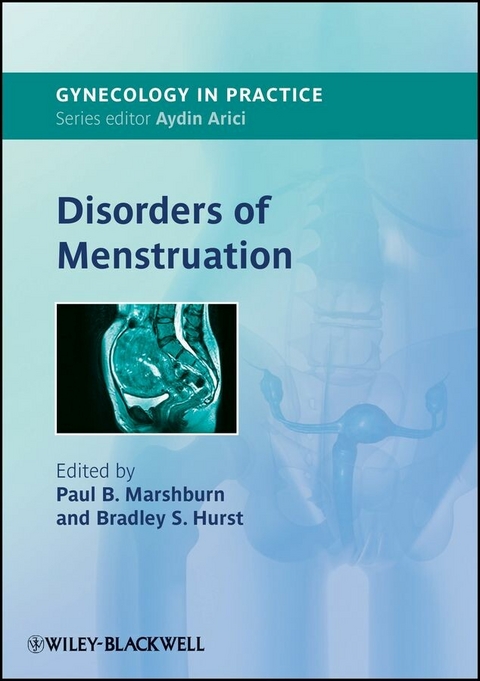 Disorders of Menstruation - 