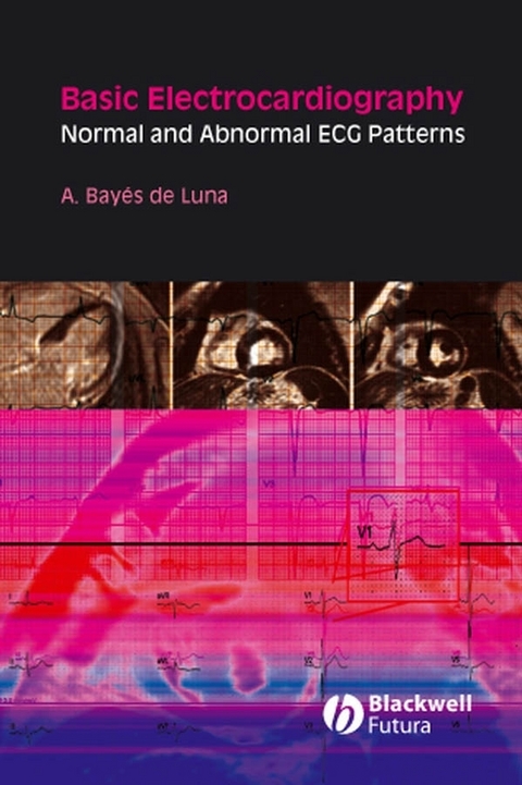 Basic Electrocardiography - Antoni Bay&eacute;s de Luna