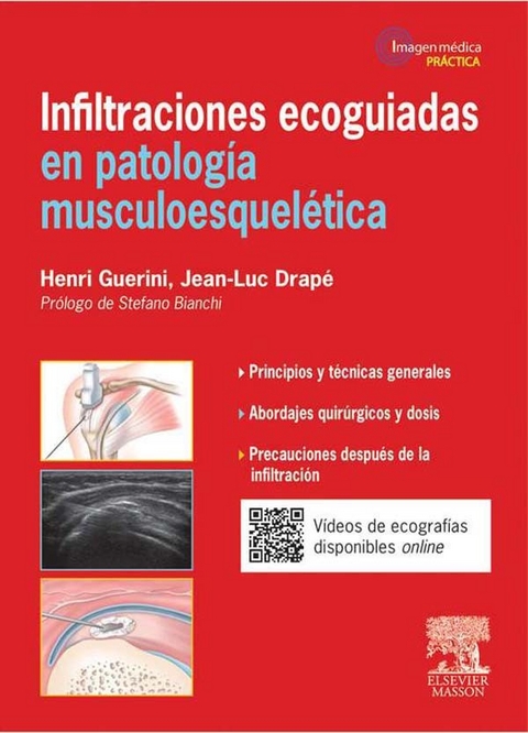 Infiltraciones ecoguiadas en patolog&iacute;a musculoesquel&eacute;tica -  Jean-Luc Drape,  Henri Guerini