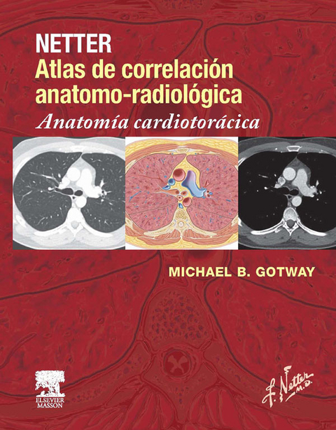 Netter. Atlas de correlaci&oacute;n anatomo-radiol&oacute;gica: Anatom&iacute;a cardiotor&aacute;cica - 