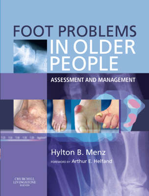 Foot Problems in Older People