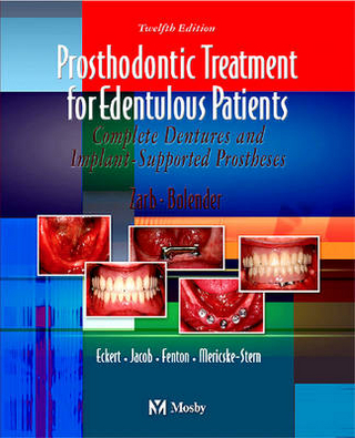 Prosthodontic Treatment for Edentulous Patients