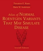 Atlas of Normal Roentgen Variants That May Simulate Disease - Theodore E. Keats, Mark W. Anderson